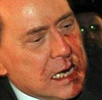 Silvio Berlusconi tras la agresin